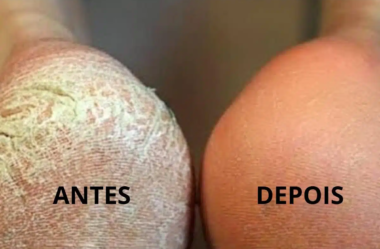 dica para pés ressecados